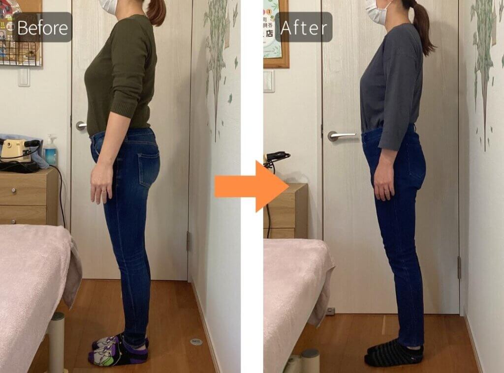 ビフォーアフター