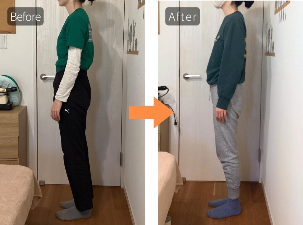 ビフォーアフター