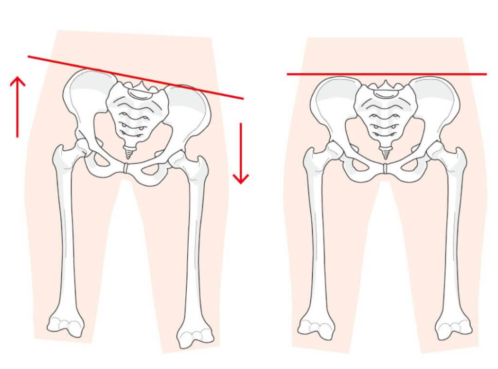 産後に骨盤がゆがむ原因のイメージ
