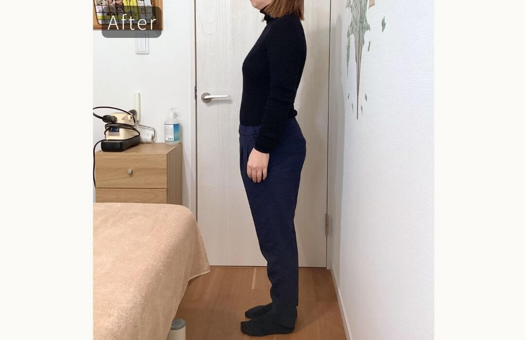 ヒップラインアフター