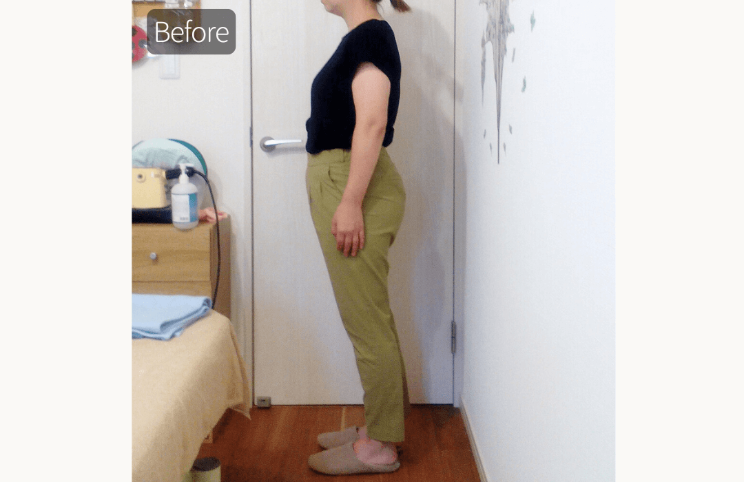 ヒップラインビフォー