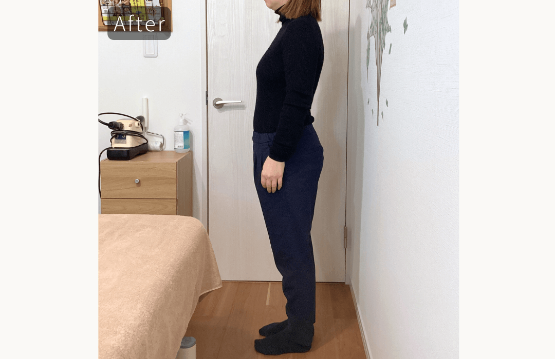 ヒップラインアフター