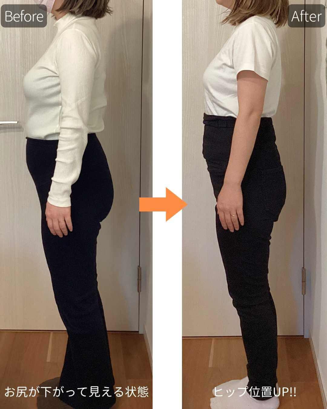 産後 骨盤矯正 ビフォーアフター