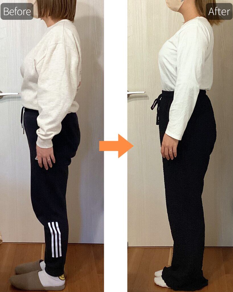 ビフォーアフター